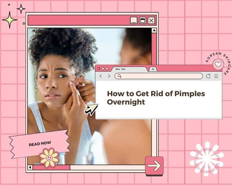 How to Get Rid of Pimples Overnight – 8 Proven Ways